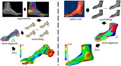 Toward improved understanding of foot shape, foot posture, and foot biomechanics during running: A narrative review